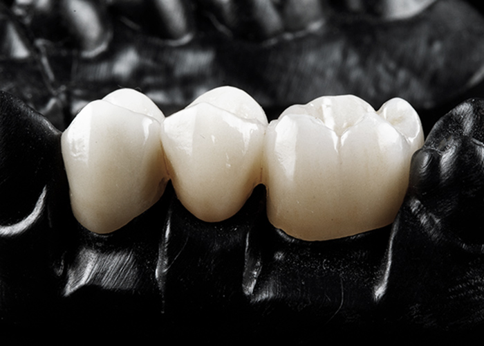 提携歯科技工所あり